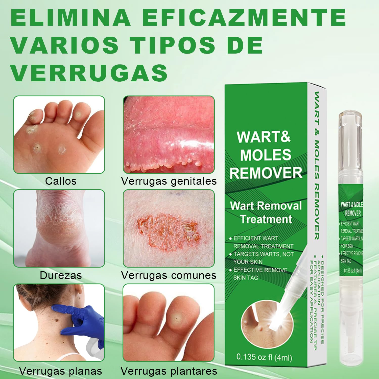 Removedor de verrugas de acción rápida para rostro y cuerpo - Lápiz con ácido salicílico y pincel de precisión | Fórmula suave para eliminar verrugas, tamaño viaje (4ml)