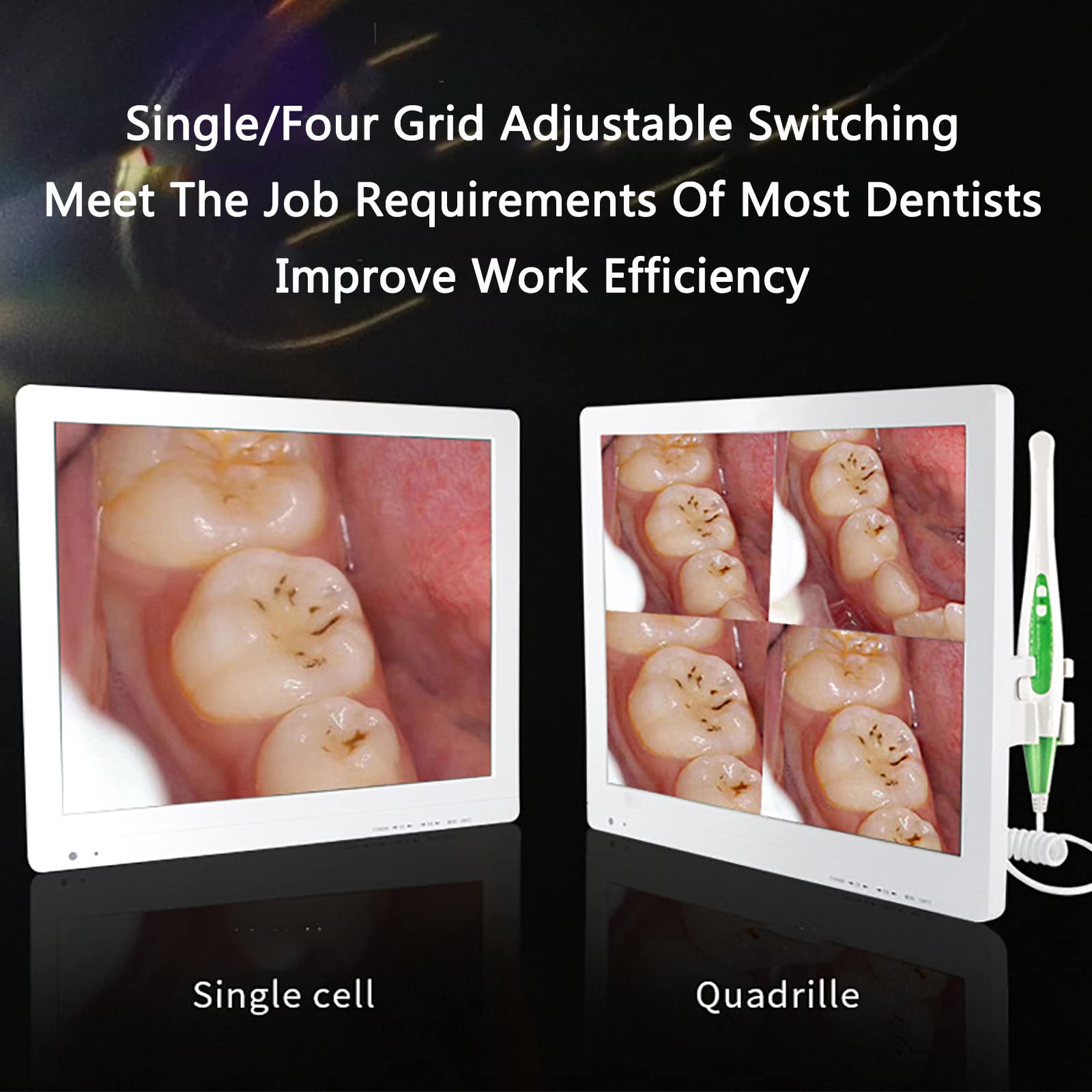 Telecamera Intraorale Dentale,Monitor per Telecamera Orale con Schermo da 17pollici E 16milioni Pixel HD, 1/4 Immagine Regolabile E Funzione Anti-vibrazioneintelligente,per Ospedalieroclinico