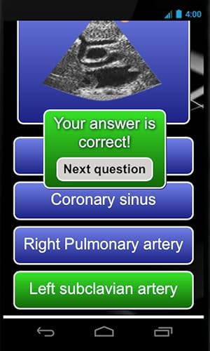 Echocardiography cases