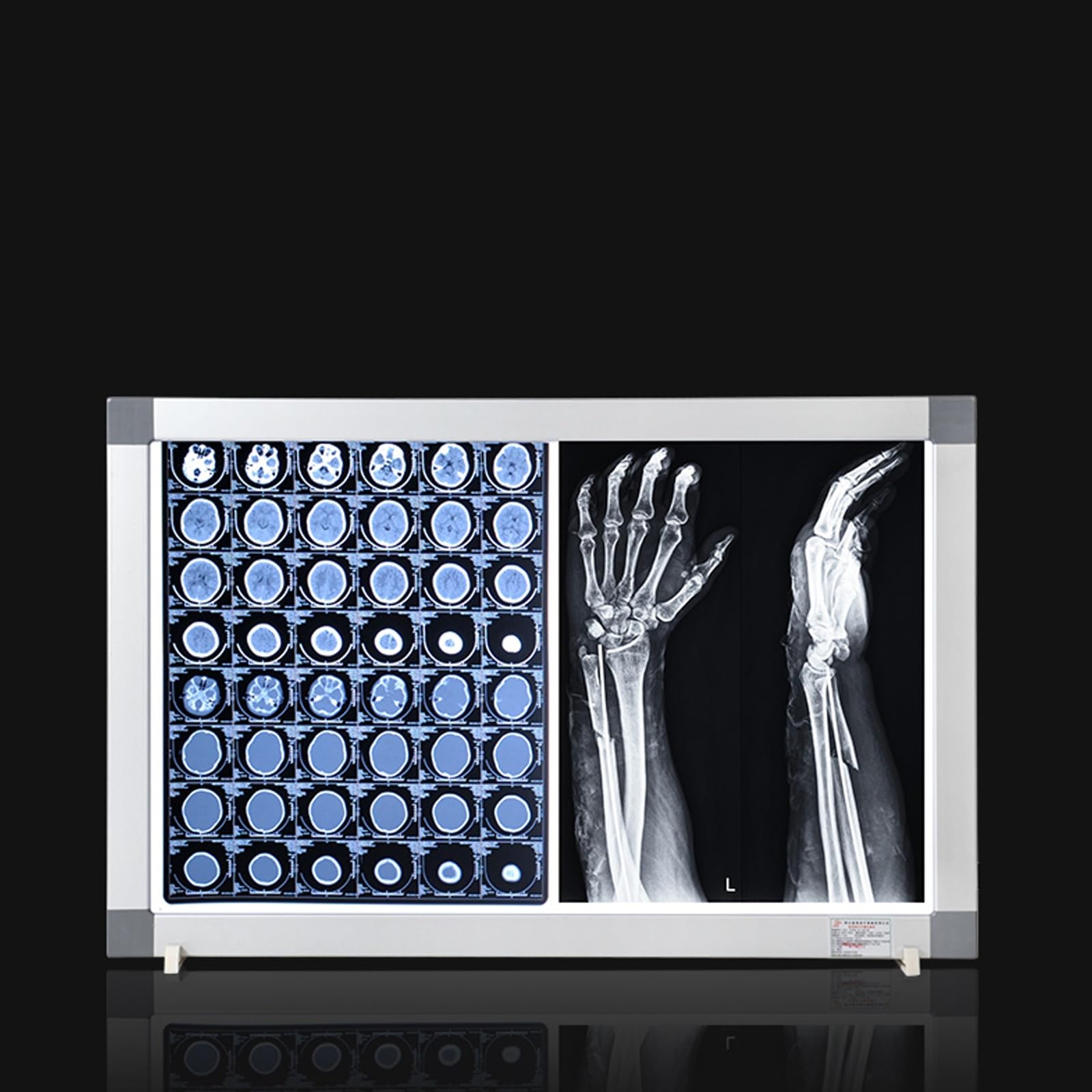 Illuminatore per Pellicole a Raggi X Led Schermo Radiografico Ultrasottile 6,5 cm Staffa Cliniche Ospedaliere 40x47x6,5cm