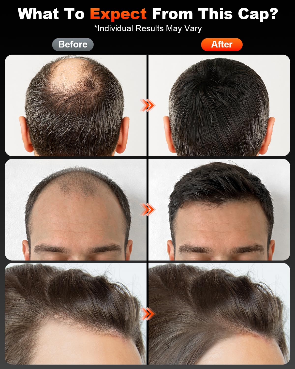 Rotlicht Haarwachstumskappe,660nm*100pcs+850nm*200pcs Haarwuchskappe Einstellbare,4 Modi & 3 Helligkeitsstufen Rotlicht Haare Einstellbare Größe,20-min Auto-Abschaltung