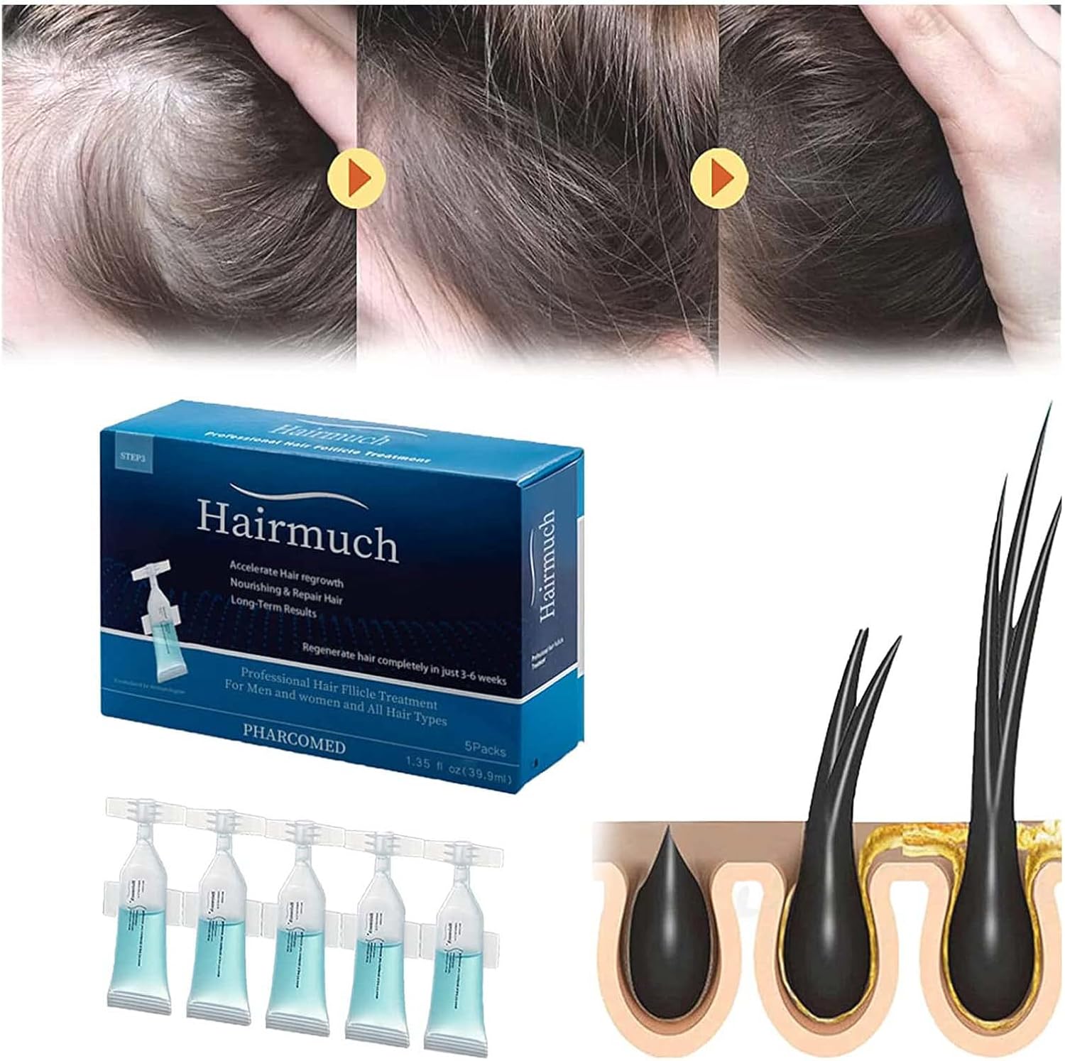 Hairmuch Hair Growth Ampoule Serum Lotion, Hair Much Hair Growth