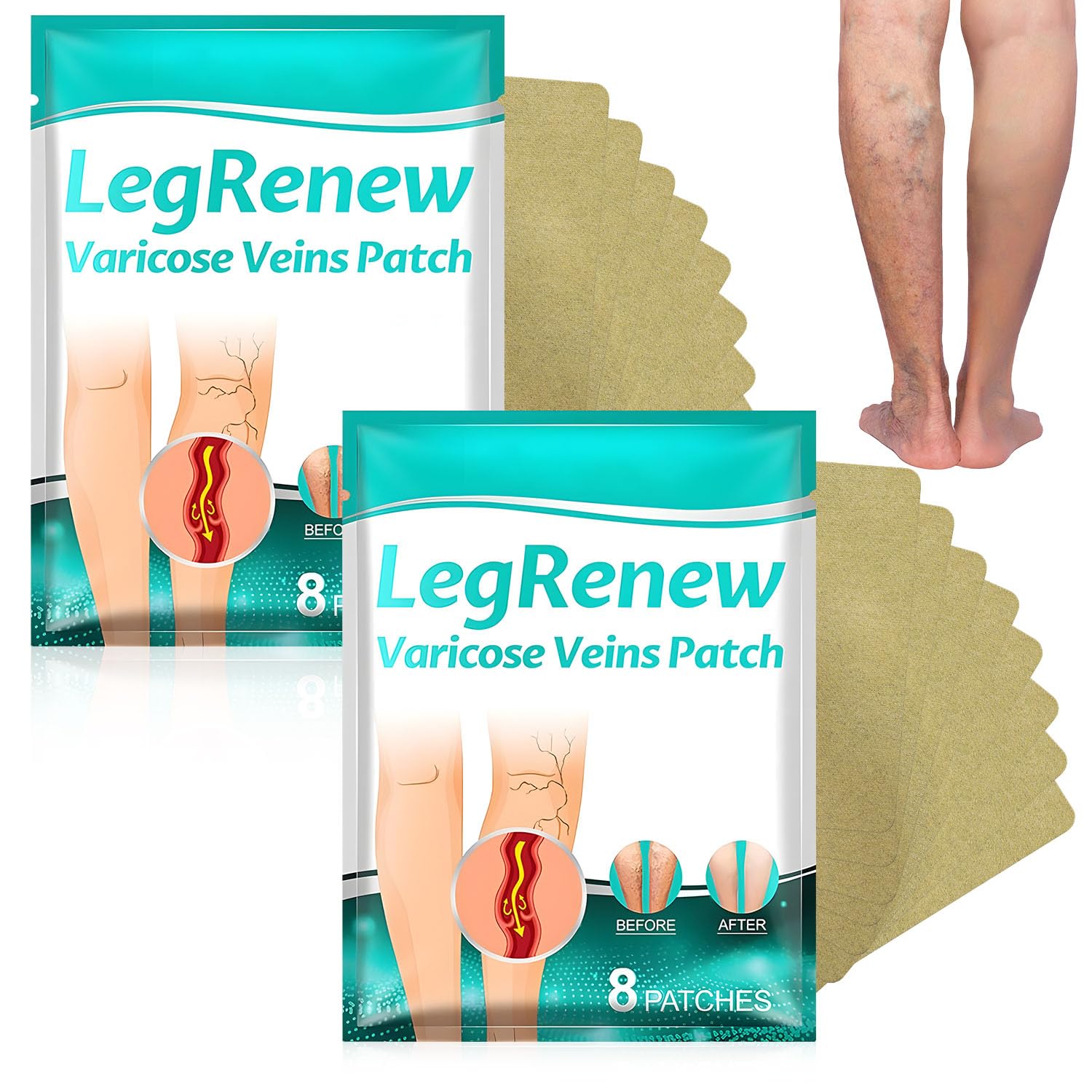 2PCS Leg Renew Varicose Veins Patch, Professional Varicose Veins Patch for Legs, Natural Ingredients for All Skin Types