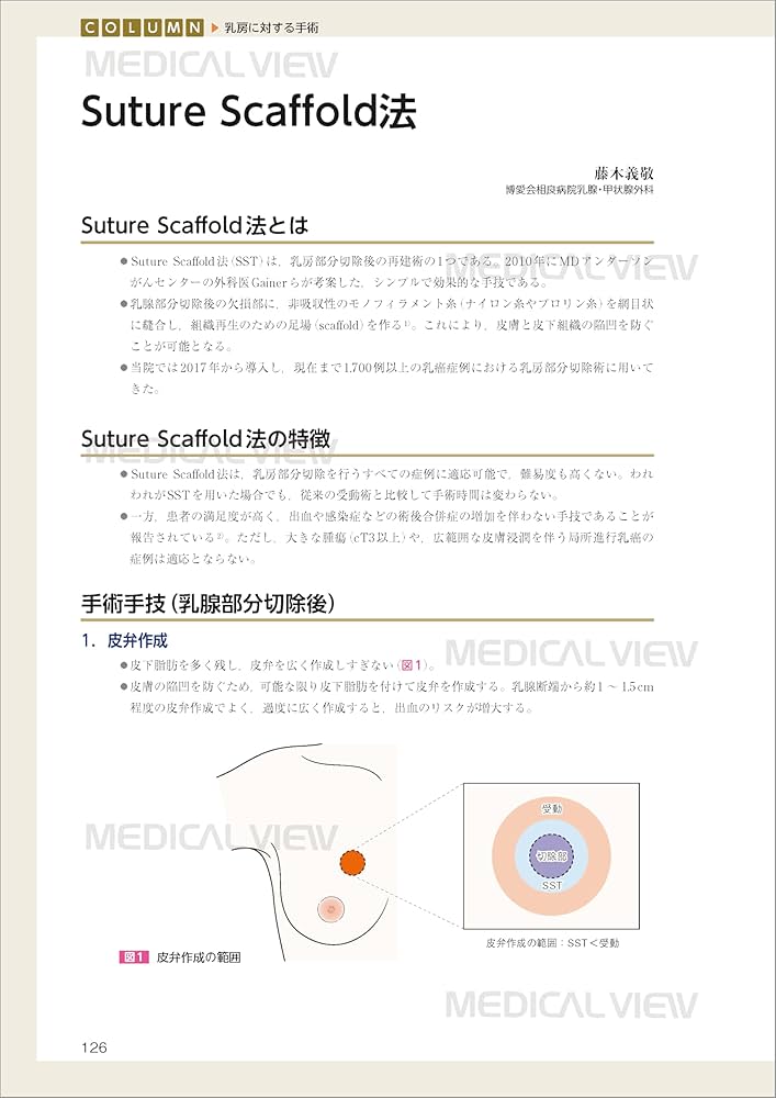 エキスパートが伝える スタンダード乳癌手術 | 増田 慎三, 井口