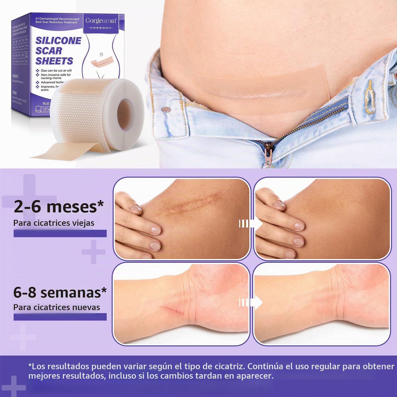 Silicone Scar Sheets,Cinta de cicatrices de silicona 1.6 '' x 60 '',Hoja de cicatrices de silicona profesional reutilizable para cicatrices quirúrgicas,Tuck abdominal, keloide, acné,Sección C