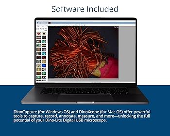 Amazon.com: Dino-Lite USB Digital Microscope AD4113TL - 1.3
