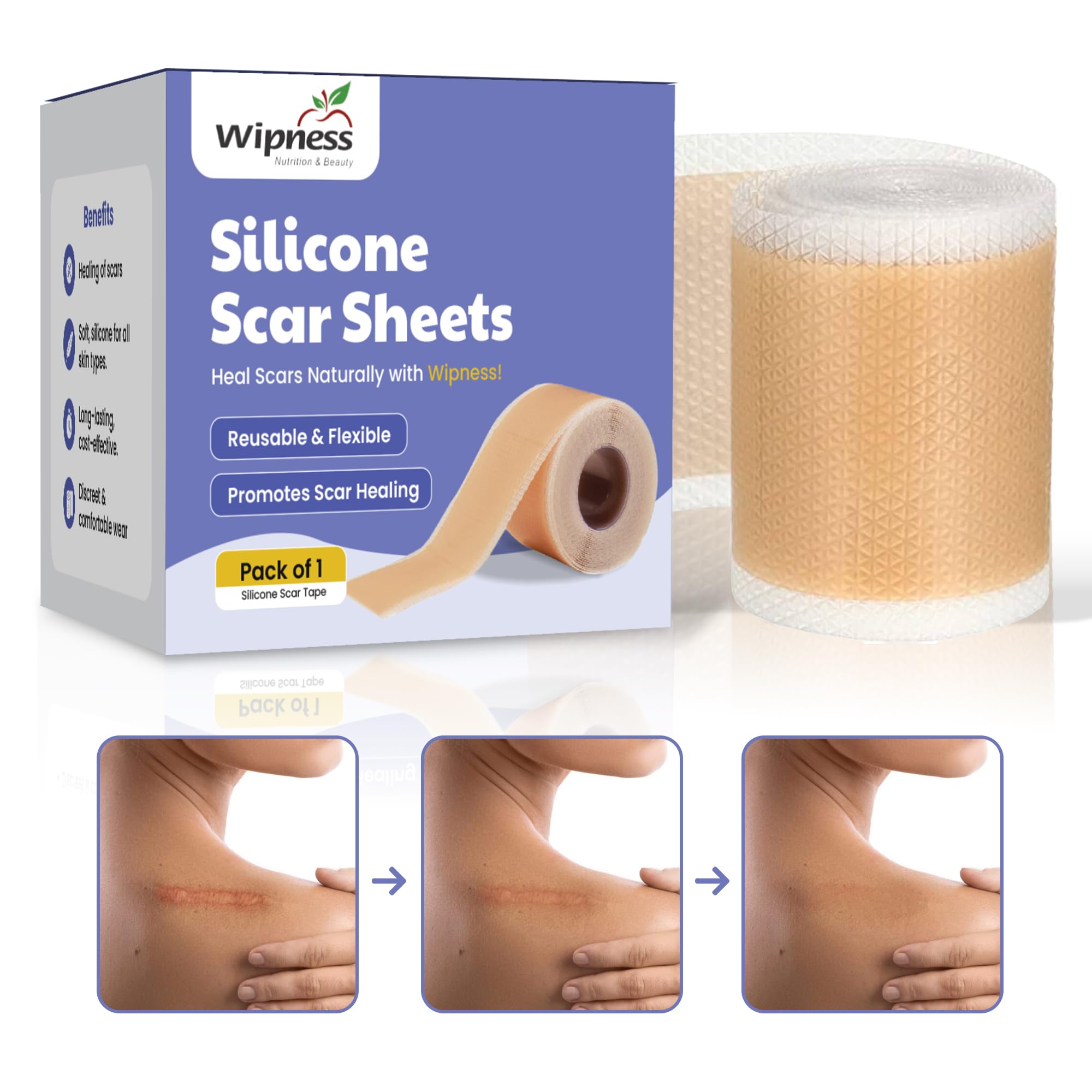 Wipness Silicone Scar Sheets 61 inches (1.6 Meters) – Reusable & Flexible Medical Grade Tape for Surgical, C-Section, Burn, Acne, Keloid, Tummy Tuck & Hypertrophic Scar Removal Tape