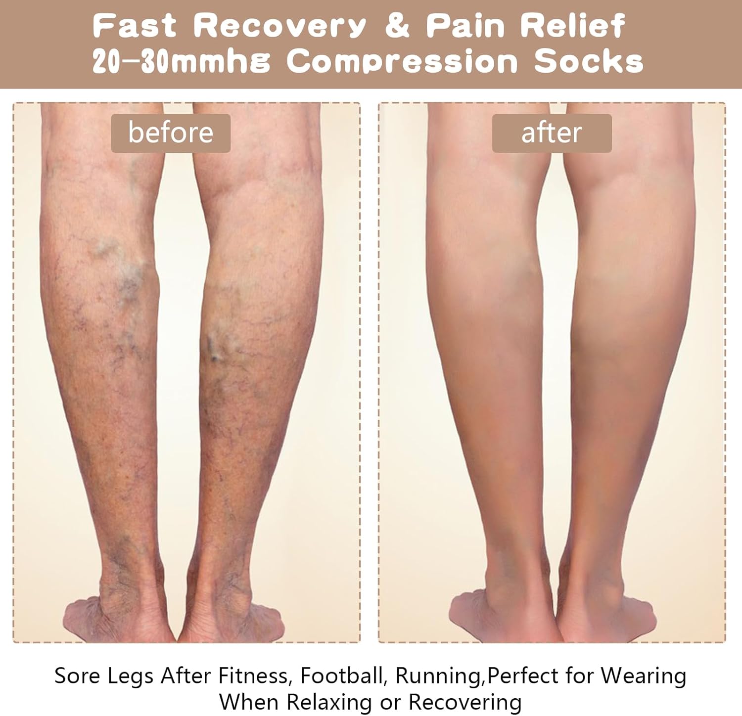 Open Toe Compression Socks for Women & Men, 2 Pairs Toeless Compression Socks 15-20 mmHg Knee High Stockings for Circulation Support, Medium, Beige/Black - Image 6