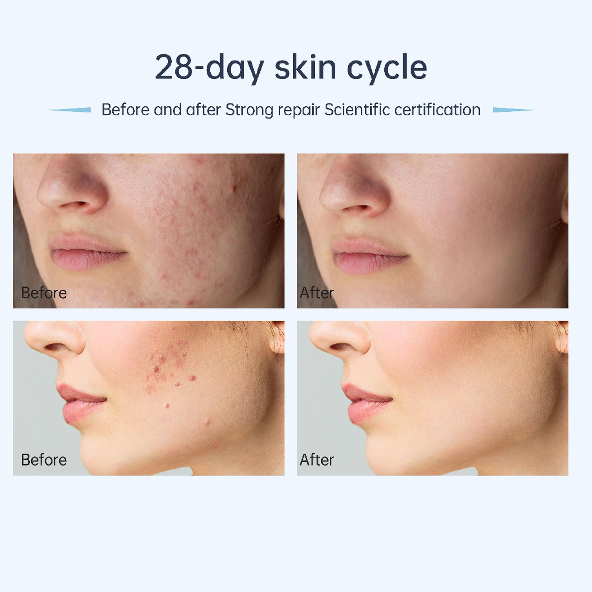 Dr Pen A11 - Penna per microneedling, per uso domestico, con micro aghi per la pelle, per uomini e donne, 0,25 mm