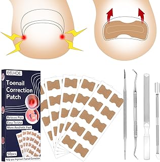 FANTESI Toenail Correction Patch, Ingrown Toenail Stick Patch, 50 Pcs Elastic Patch Curved Toenails Brace Stickers With 4 Pcs Nail Correction Tool for Men Women Toenail Care Tool
