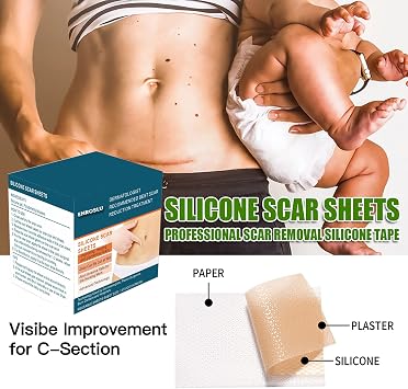 Upgrade Silicone Scar Sheets (1.6 x 120- 3 Meter), Medical Grade Silicone Scar Tape, Scar Removal Strips for Acne, Burn Scars C-Section & Keloid Surgery Scars Sheets Treatment Sheets