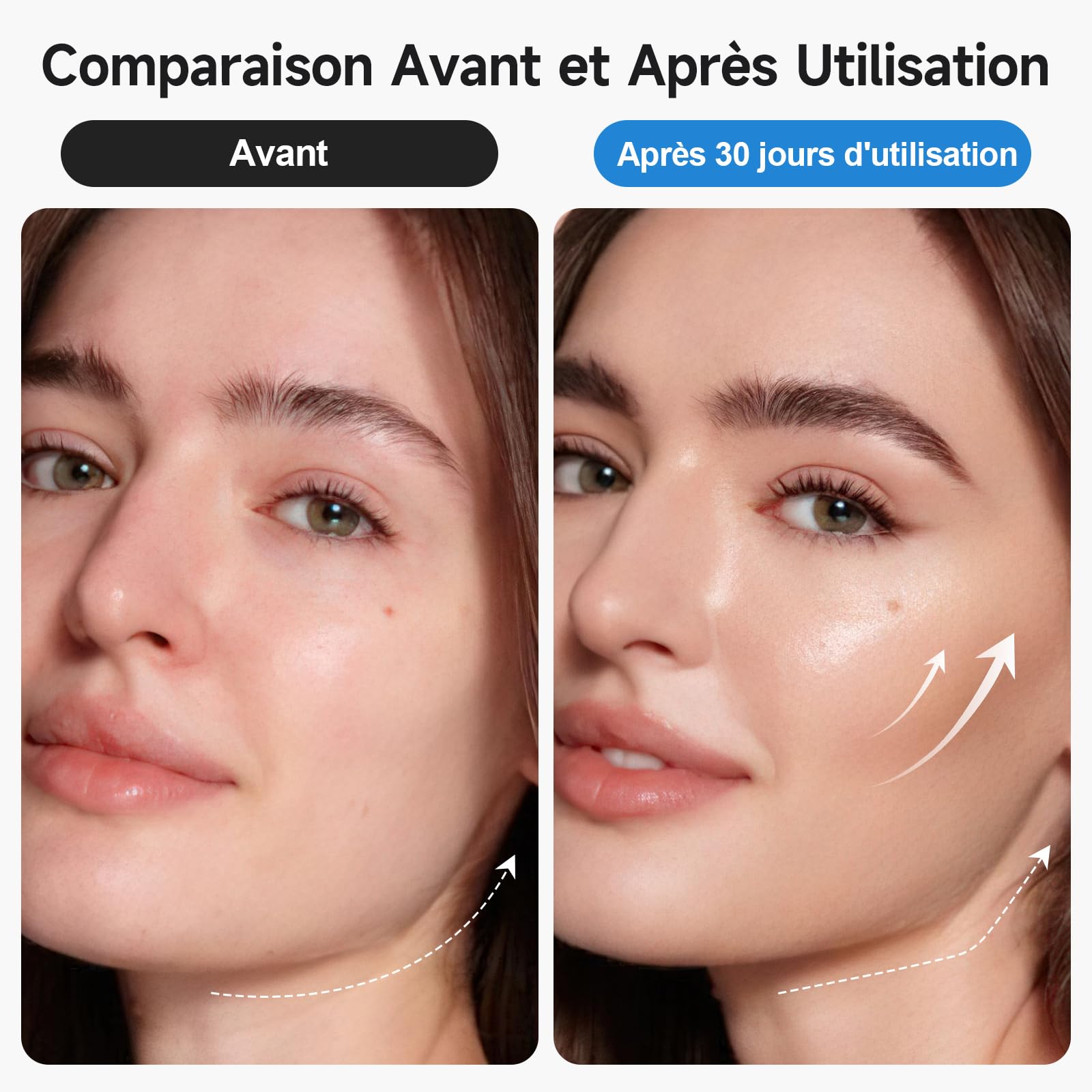 Ventouses 3 en 1 anti-cellulite | Ventouses, EMS, lumière rouge. Ventre/jambes/fessiers, 3–5 min/jour, peau ferme