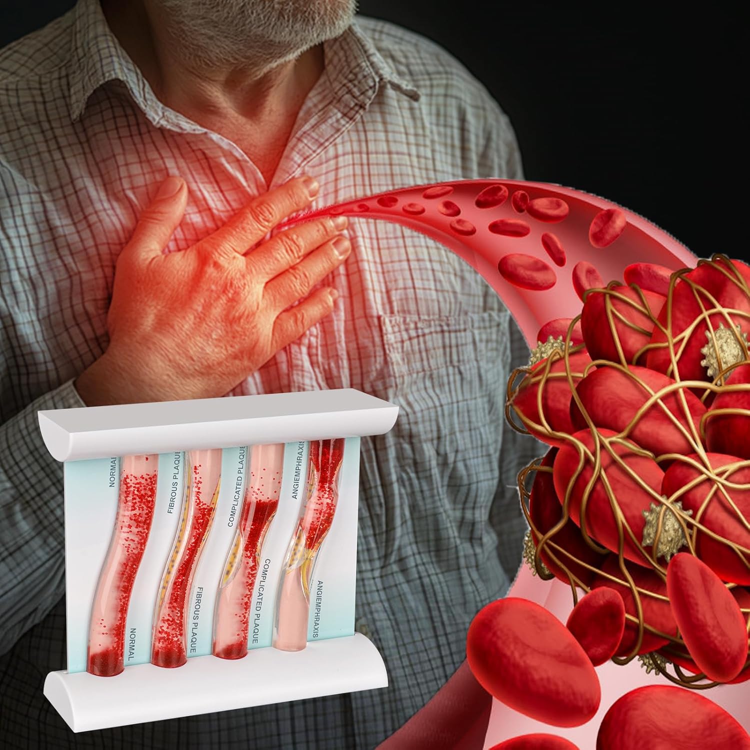 SimCoach Low-Density Lipoprotein LDL Blood Vessel Model for Medical Patient Doctor Teaching, Vascular Demonstration Training Tool, Four Stage Vascular Conditions