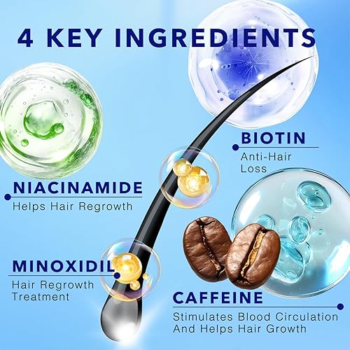 Miniatura 2 de Espuma de minoxidil al 5% para el crecimiento del cabello, tratamiento tópico de pérdida de cabello para hombres para que vuelvan a crecer más