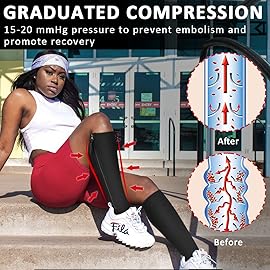 Ailaka Medical Compression Socks with Zipper, Knee High 15-20 mmHg Compression Socks for Women Men, Open Toe Support Socks for Varicose Veins, Edema, Recovery, Pregnant, Nurse