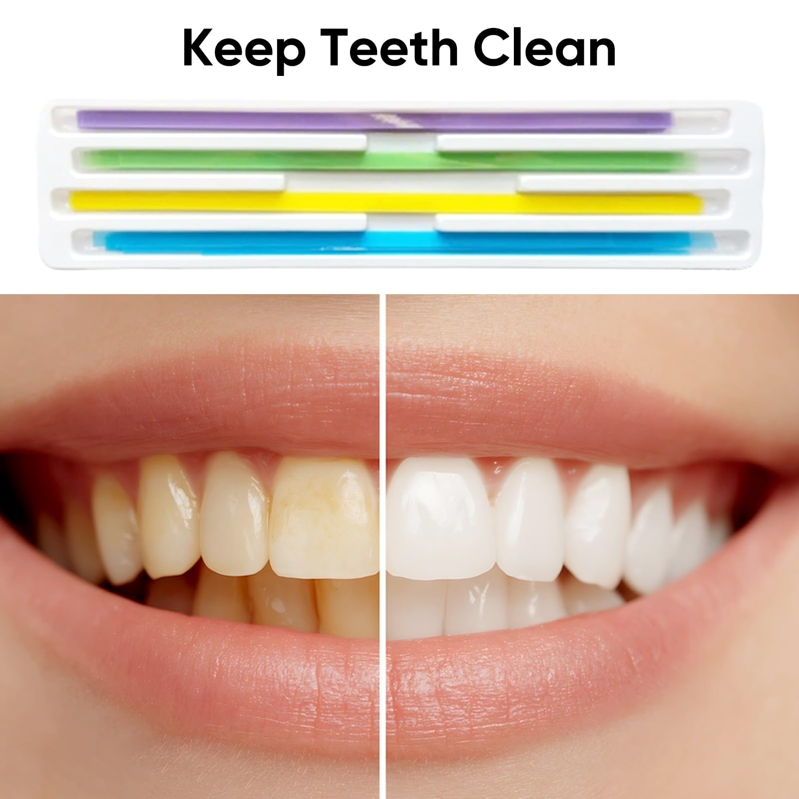 Lima dentale per denti scheggiati 60 pezzi strisce abrasive dentali smerigliatura levigatura pre-lucidatura