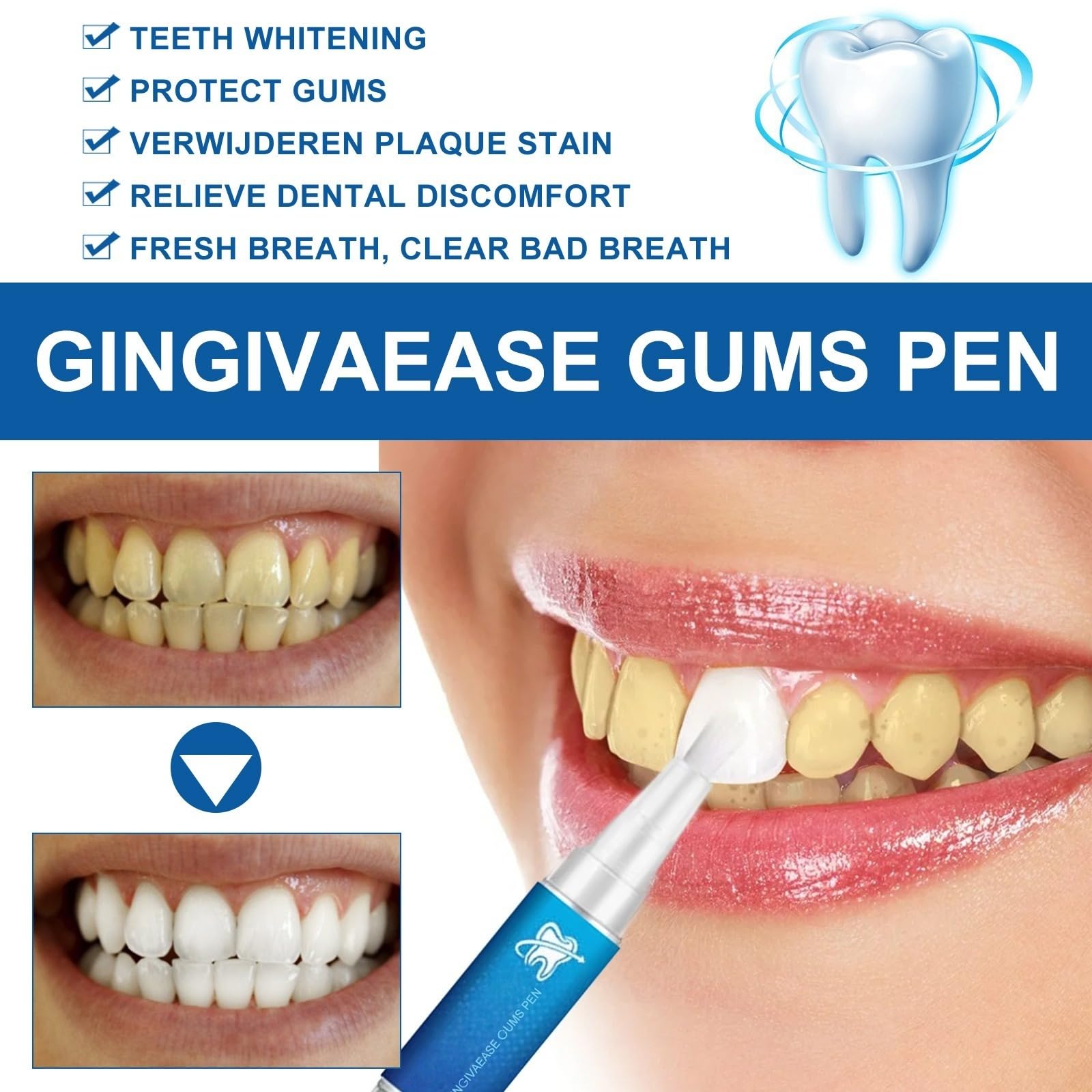 Gel sbiancante dei denti - Ripara i Gonfiori delle Gengive - Penna sbiancante dei denti, terapeutico - Dentifricio - Trattamento della recessione delle gengive - Ringiovanisci il tuo