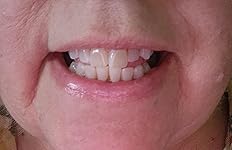 Review Image by DLK DLK