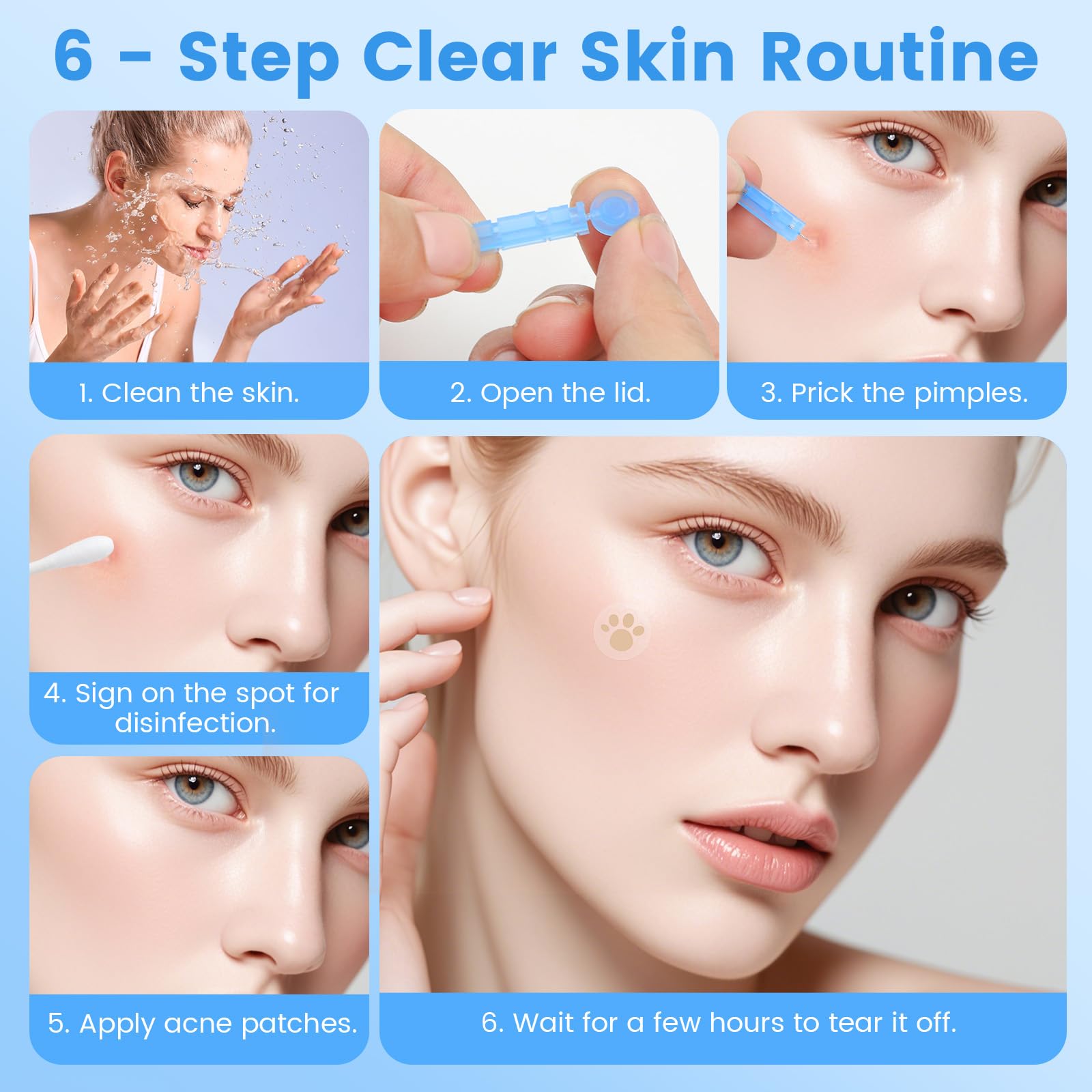 100 Blemish Remover Acné Aguja - Desechables Eliminar Espinillas, Removedor de Puntos Blackhead con 108 Parches Puntuales, Afilado Desechable Blackhead para Limpiador Granos