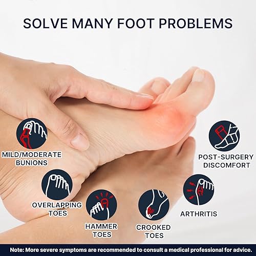 Miniatura 10 de Fit Geno Corrector de juanetes para mujeres y hombres, con separador ajustable de dedo gordo para aliviar el dolor, corrección de juanetes