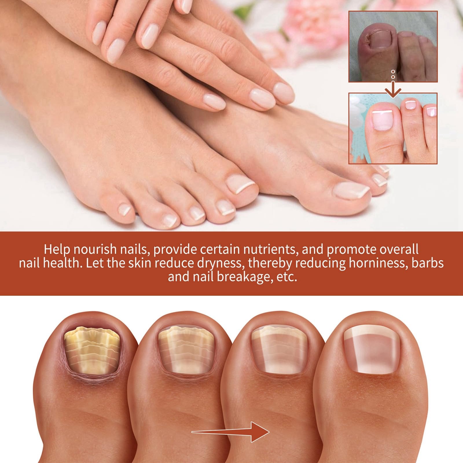 BigyQiu Nail Growth & Repair Serum - Strengthens & Hardens Damaged Nails, Blue, 15 ml (Pack of 1) - Image 3