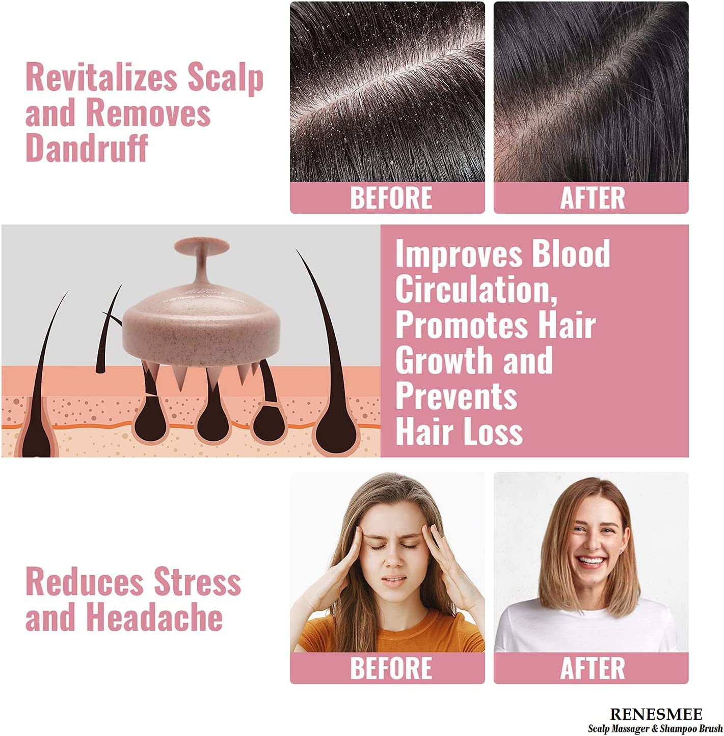 RENESMEE scalep massager shampoo brush, eco-friendly wheat straw body with soft silicone bristles, hair scalp scrubber, scalp exfoliator | Russian removal, prevents hair loss (pink) RENESMEE scalep massager shampoo brush, eco-friendly wheat straw body with soft silicone bristles, hair scalp scrubber, scalp exfoliator | Russian removal, prevents hair loss (pink)