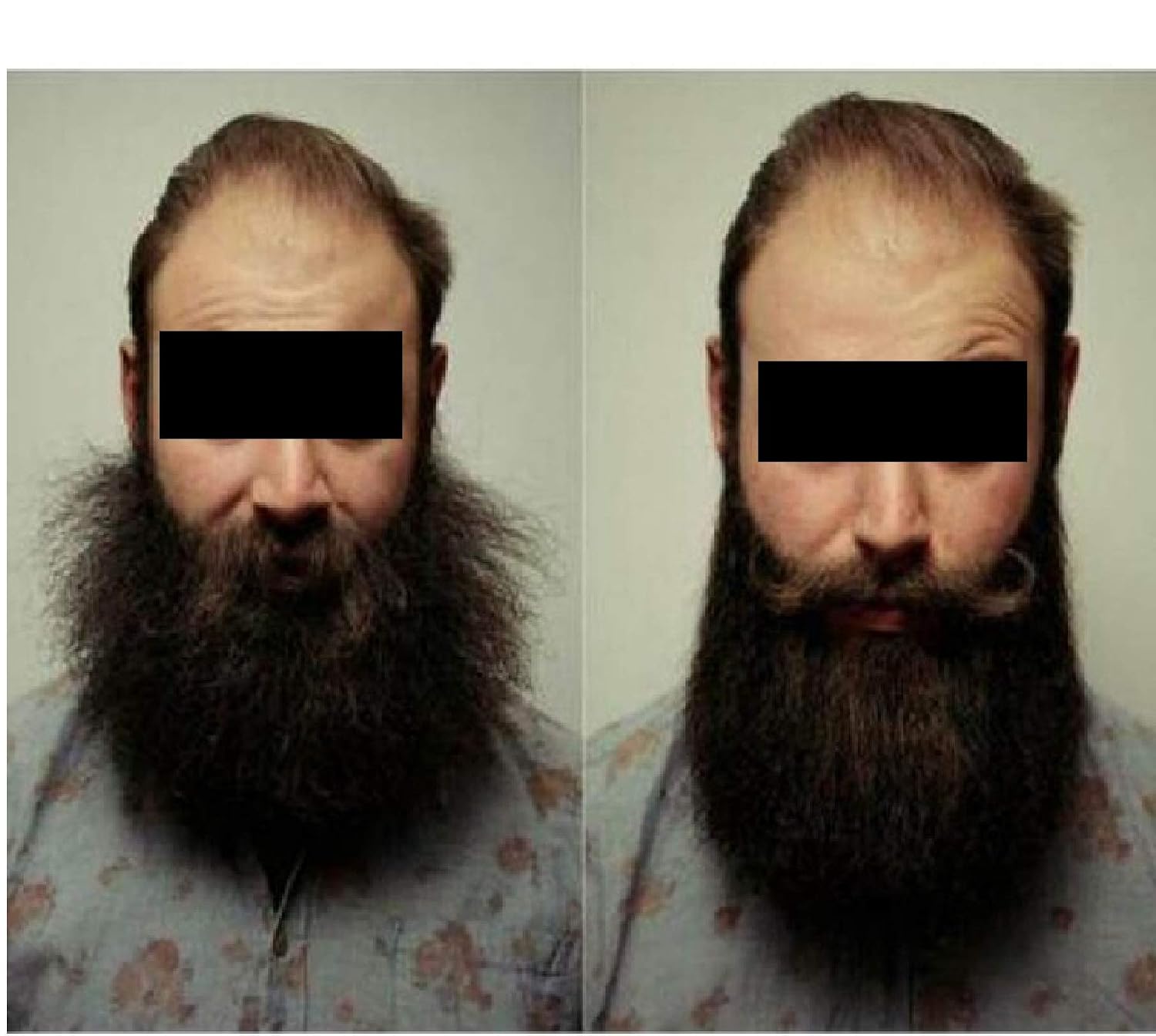 Amazon.com: Plancha para barba para hombres, alisador de pelo, alisador de  barba rápido, peine multifuncional, rizador de pelo, herramienta de  muestra. : Belleza y Cuidado Personal
