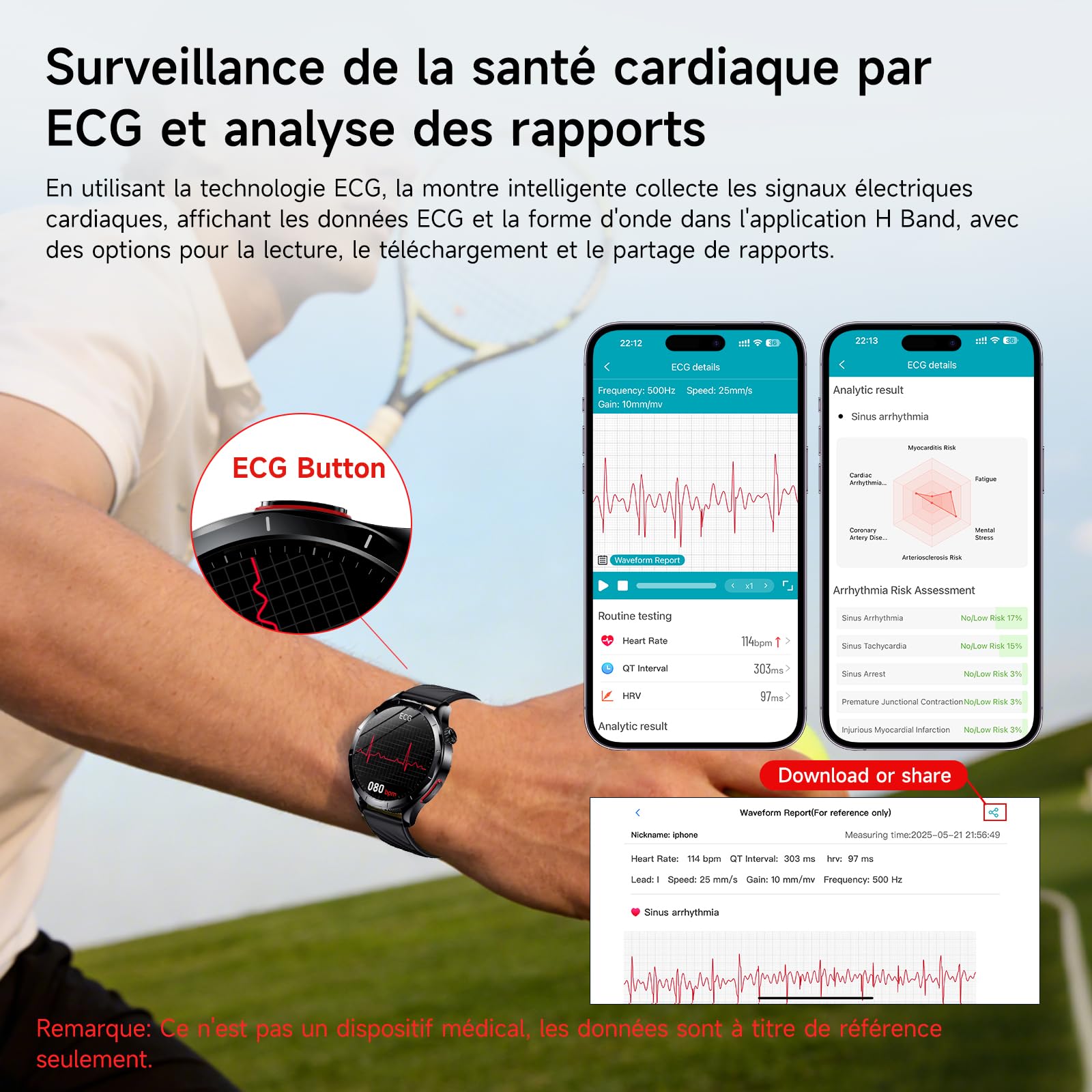 YUPENG 2026 Nouvelle Montre Connectée Homme ECG+HRV/Pressιon artérιelle | ECG/HRV/Pressιon artérιelle/IMC/Acide urique, 1.43" AMOLED/Appels Bluetooth/SOS, 24H Sommeil/Cardiofréquence, Android/iOS
