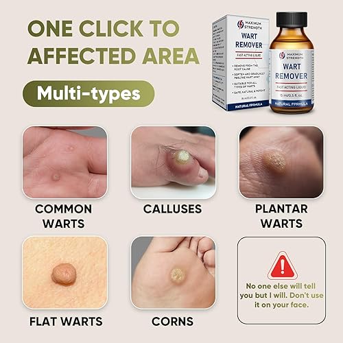 Miniatura 4 de "STAY STOKED" Removedor de verrugas, removedor de verrugas de máxima resistencia, tratamiento resistente para verrugas plantares rebeldes, callos y