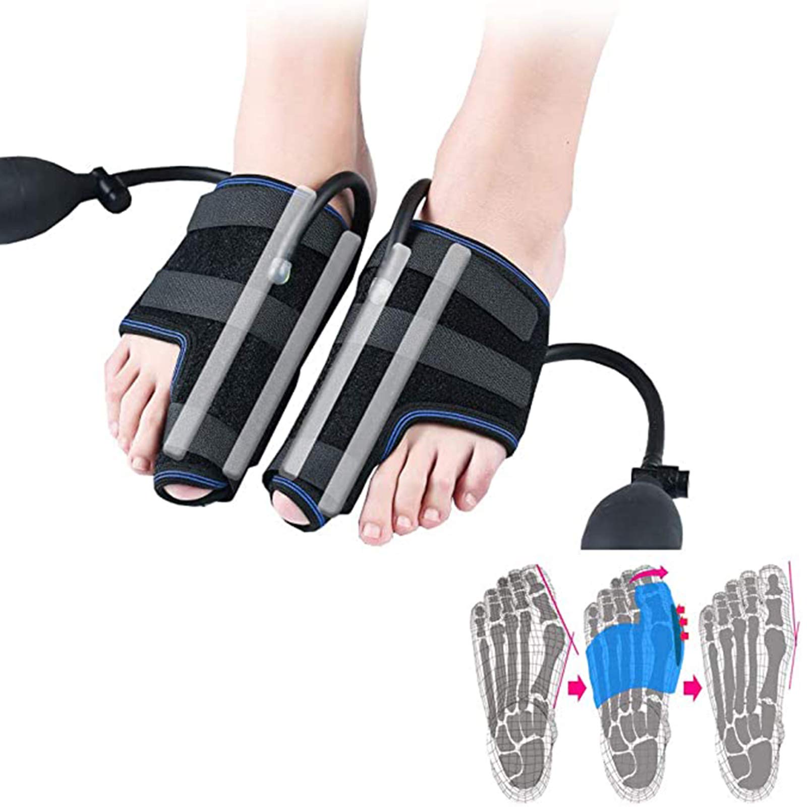 1 Par De Pulgar En Valgo Ortopédico, Soporte Neumático para Enderezar El Dedo del Pie, Presión Barométrica Controlable,Rosado
