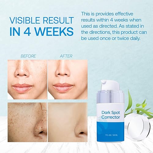 Miniatura 2 de Removedor de manchas oscuras para cara y cuerpo Bestkiss Corrector de manchas oscuras para cara y cuerpo - Eliminador de pecas de manchas marrones