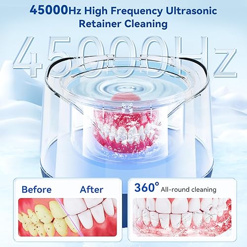 Miniatura 2 de Limpiador ultrasónico de retenedores  Limpiador ultrasónico profesional de 45 KHz  Limpiador ultrasónico de joyas para retenedores, dentaduras,