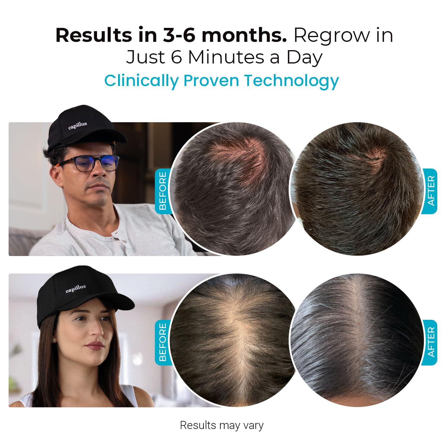 Capillus SPECTRUM Red Light Therapy for Hair Growth Hair Red Light Therapy Red Light Cap for Hair Regrowth, 312 Laser Cap for Hair Regrowth Red Light Hair Therapy Laser Hair Growth Cap +Bluetooth App