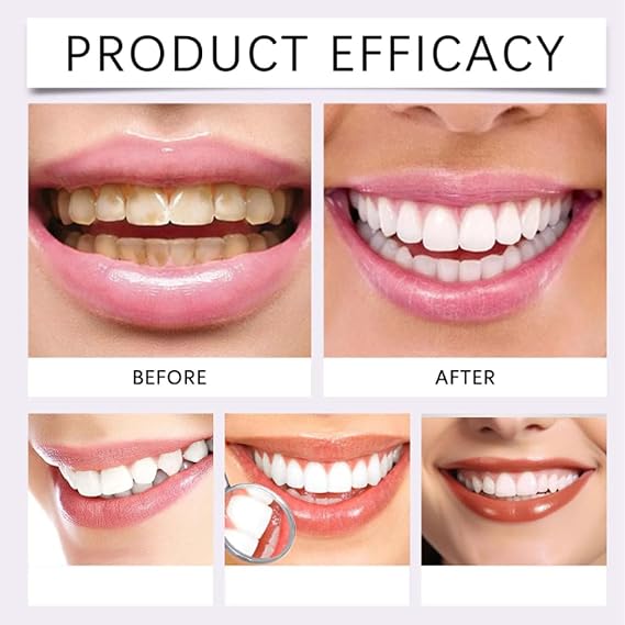 7-Pro Intensive Toothpaste, 7PRO Intense Whitening Toothpaste with 7 Probiotics for Teeth (1)