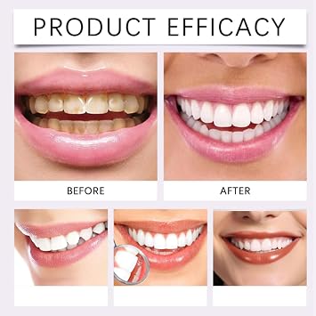 7-Pro Intensive Toothpaste, 7PRO Intense Whitening Toothpaste with 7 Probiotics for Teeth (1)