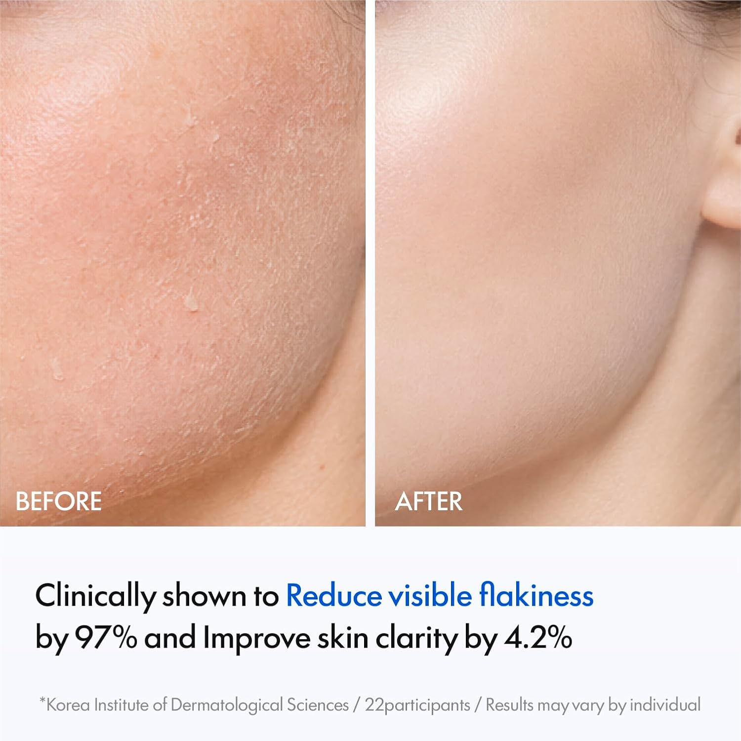 PDLLA Refinng First Essence, Gentle Exfoliating Face Toner with PHA ·LHA ·AHA·BHA·Phytic Acid, Skin Cycle Care for Smoother Texture, Radiant & Clear Skin, Korean Skincare, 5.07 fl oz