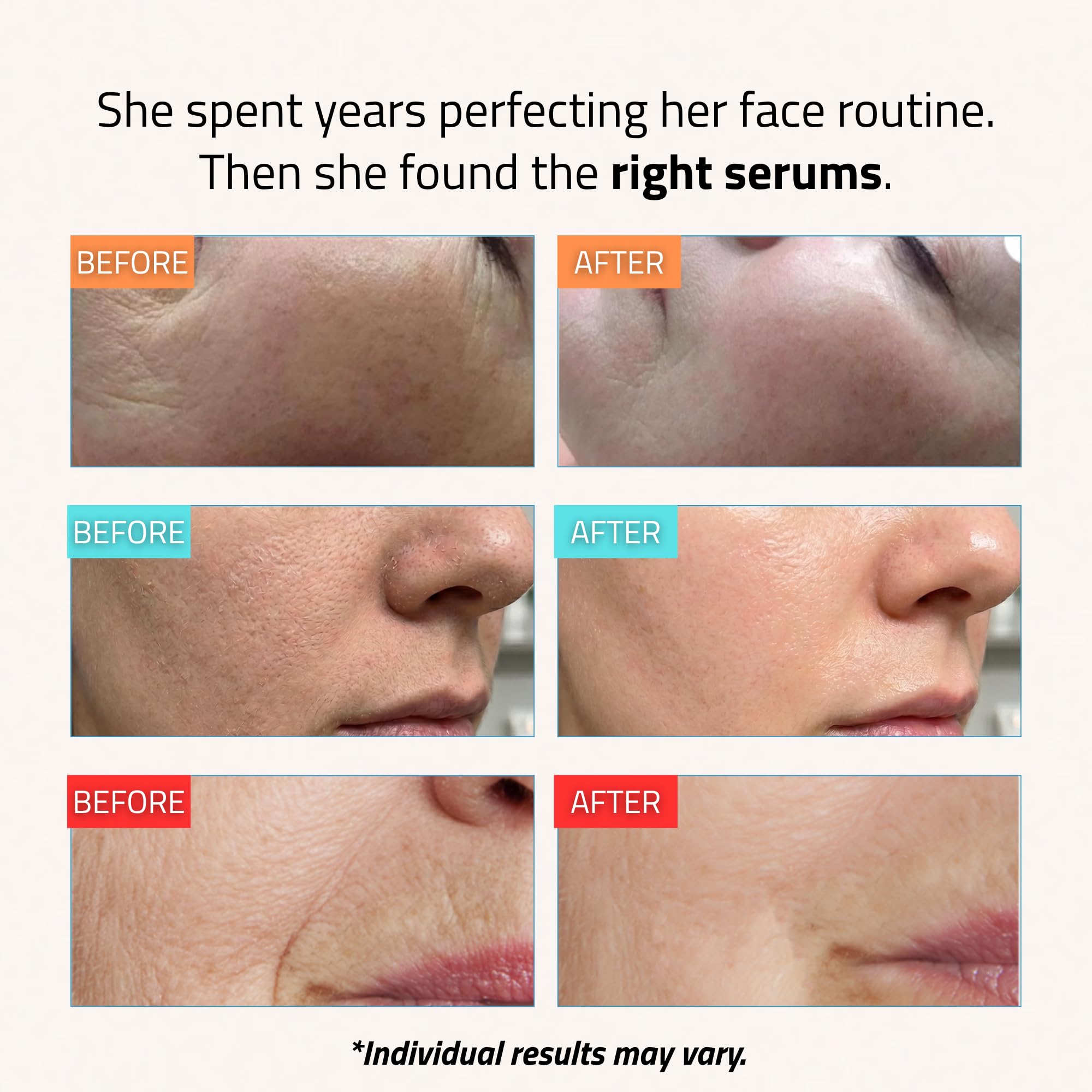 YEOUTH Zestaw do Pielęgnacji Skóry: Serum z Kwasem Hialuronowym do Twarzy, Serum z Retinolem do Twarzy i Witaminą C, Zestaw do Pielęgnacji Skóry 3x30ml | Zestaw do pielęgnacji skóry z serum retinolowym, serum z czystym kwasem hialuronowym i serum z witami