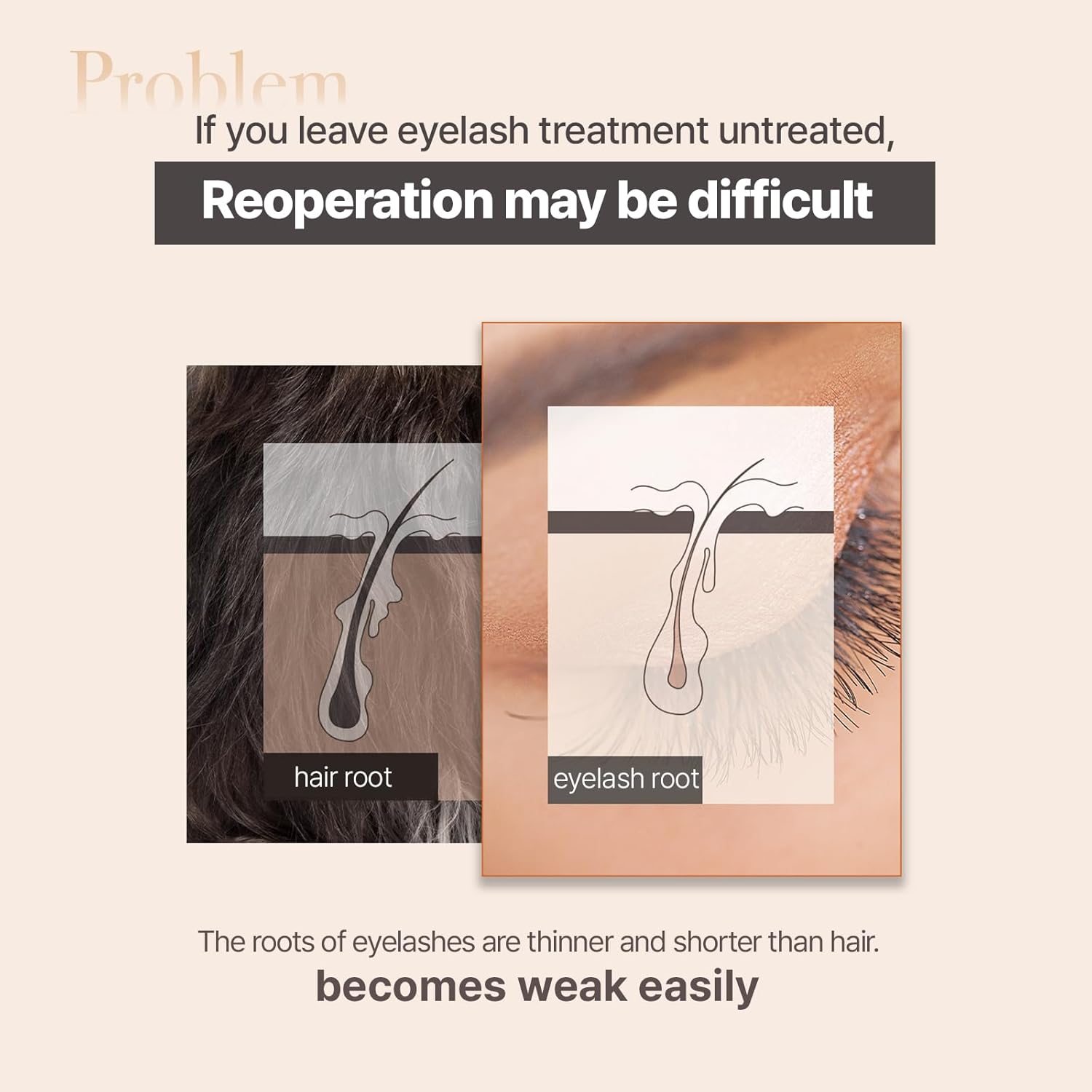 Eyelash Growth Serum for Longer & Fuller Lashes, Peptide & Biotin Lash Enhancing Serum, Volume & Curl Care, Gentle for Sensitive Eyes, Korean Lash Serum 8ml