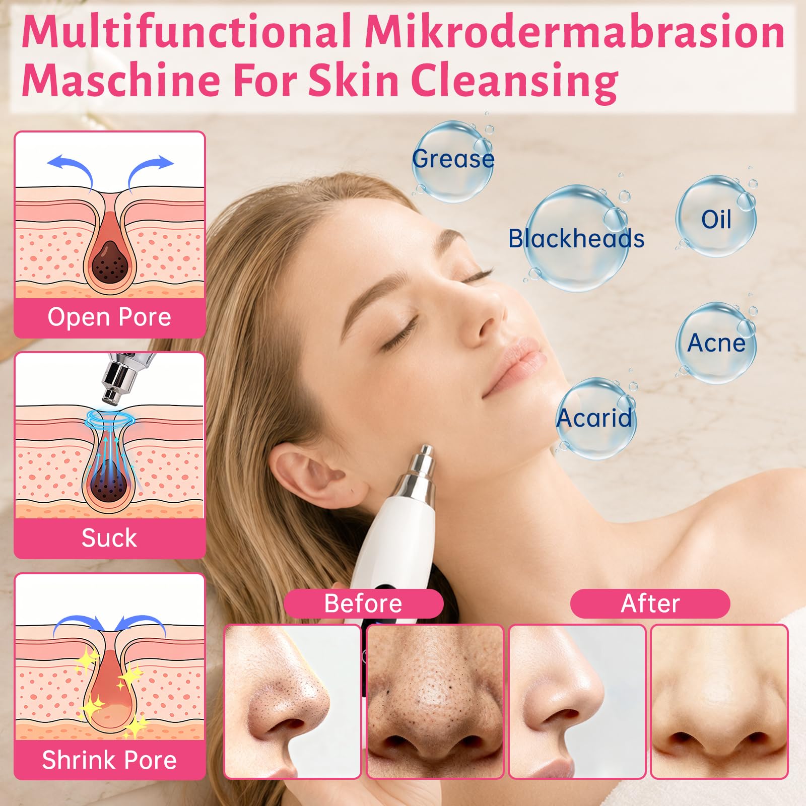 Macchina per microdermoabrasione diamantata, kit viso senza fili, portatile, per la cura della pelle domestica, 7 modalità di aspirazione regolabili con 9 teste diamantate
