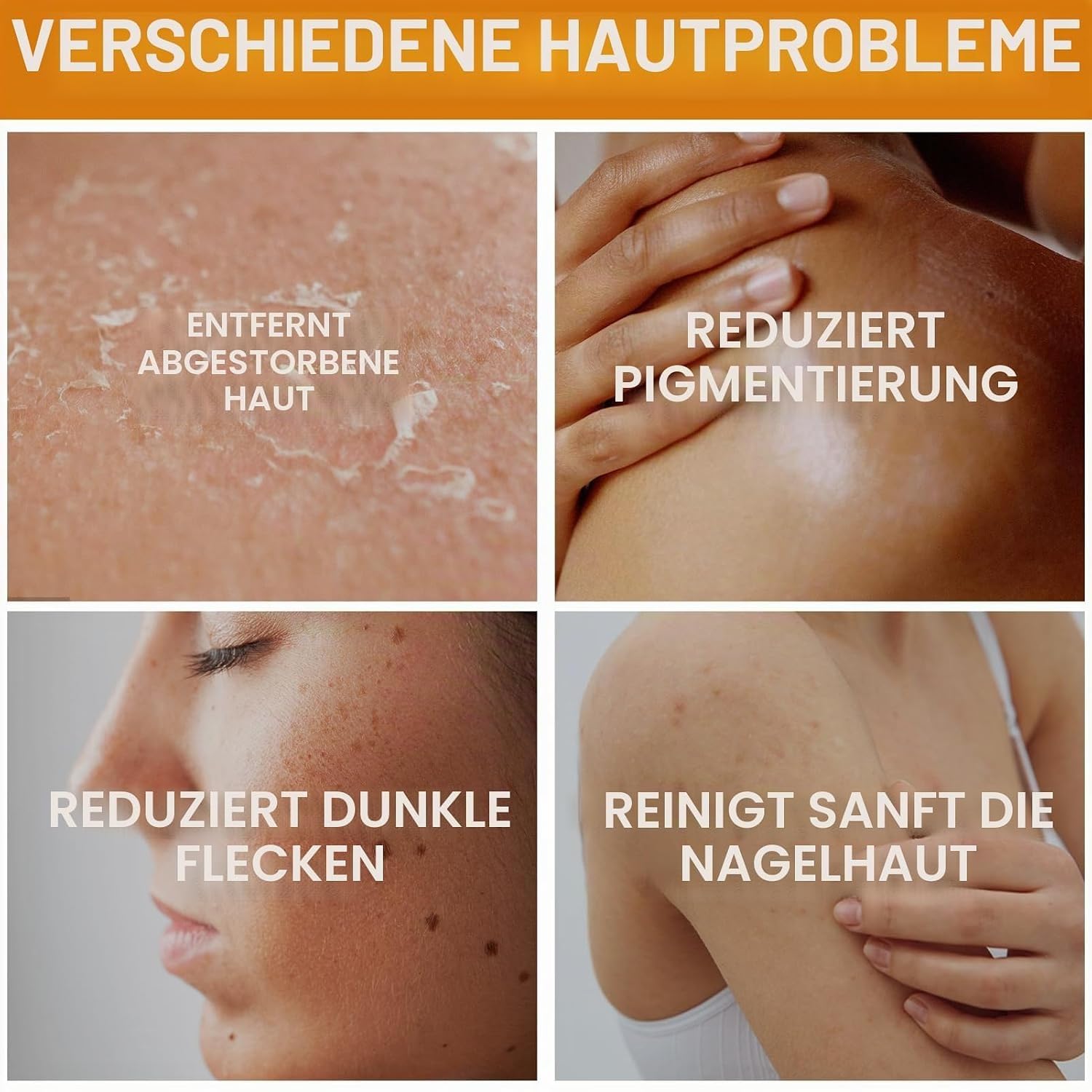 Zanari Rückenseife gegen Akne (2 Schachtel) | Vitamin C Seifenstück Hyperpigmentierung, feuchtigkeitsspendende Kurkuma-Seife gegen Akne, schwarze Flecken