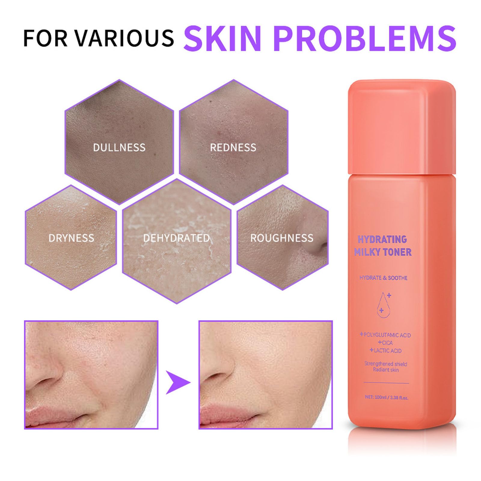 Milky Toner für das Gesicht – feuchtigkeitsspendendes und beruhigendes Gesichtswasser mit taufrischem Finish, Hautbarriere-Unterstützungsformel für alle Hauttypen, antihaftbeschichtete