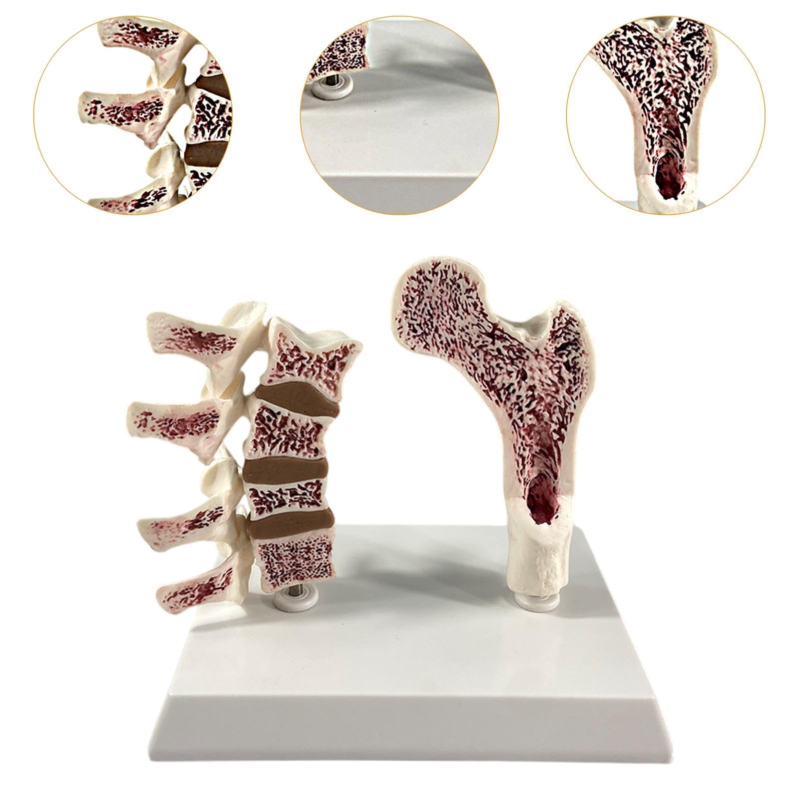 Modelo Portátil de Fémur Humano con Osteoporosis, Esqueleto Educativo con Vértebras, Kit de Aprendizaje de Material de PVC, Adecuado para La