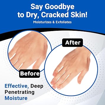 Dermal Therapy Alpha Hydroxy Lotion 10% Urea + 10% Lactic Acid, Fragrance-Free Body Lotion for Dry, Cracked Skin, Non-Greasy Exfoliating Moisturizer & Keratosis Pilaris Treatment, 16 fl oz (474 ml)