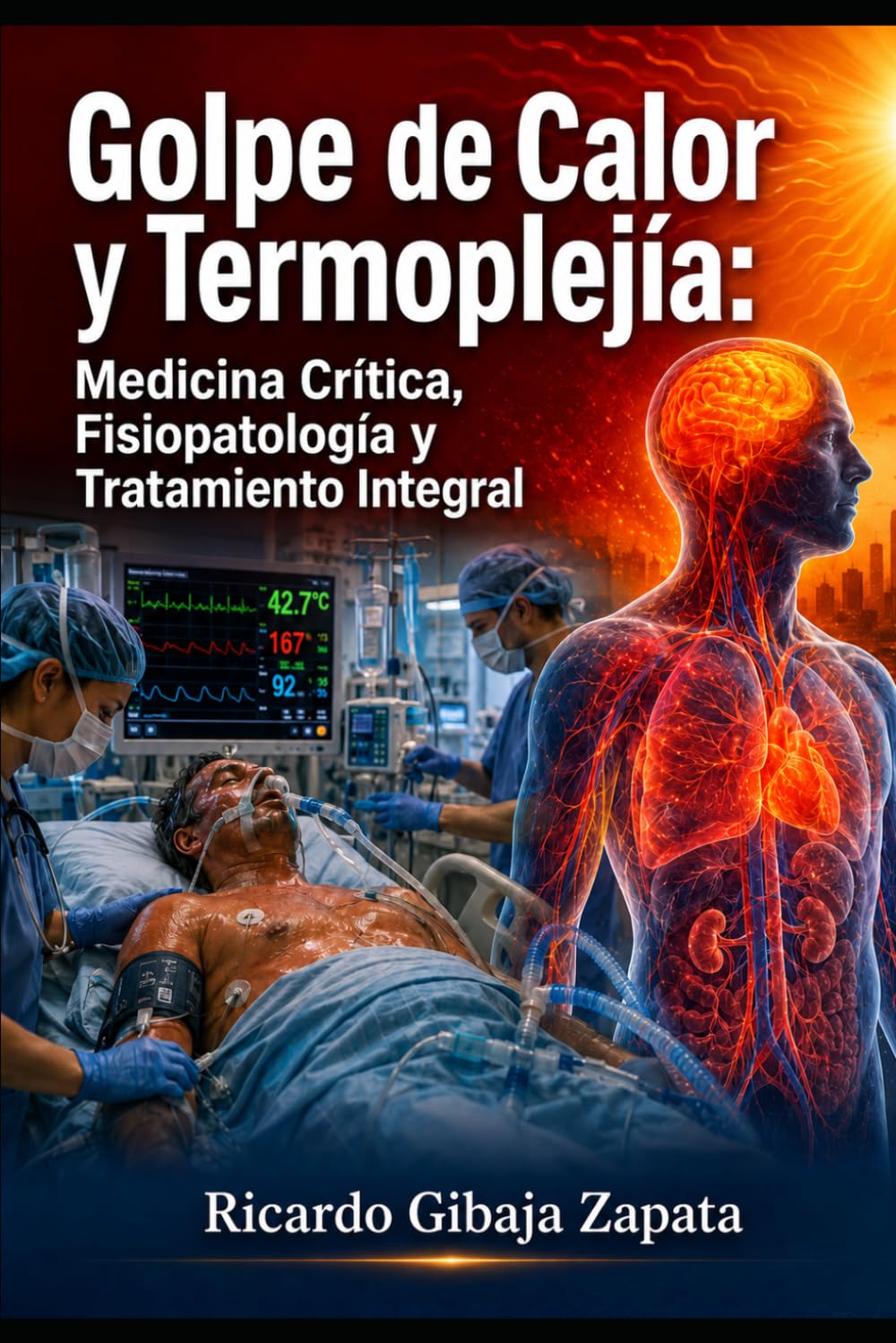 Golpe de Calor y Termoplejía Medicina Crítica, Fisiopatología y Tratamiento Integral