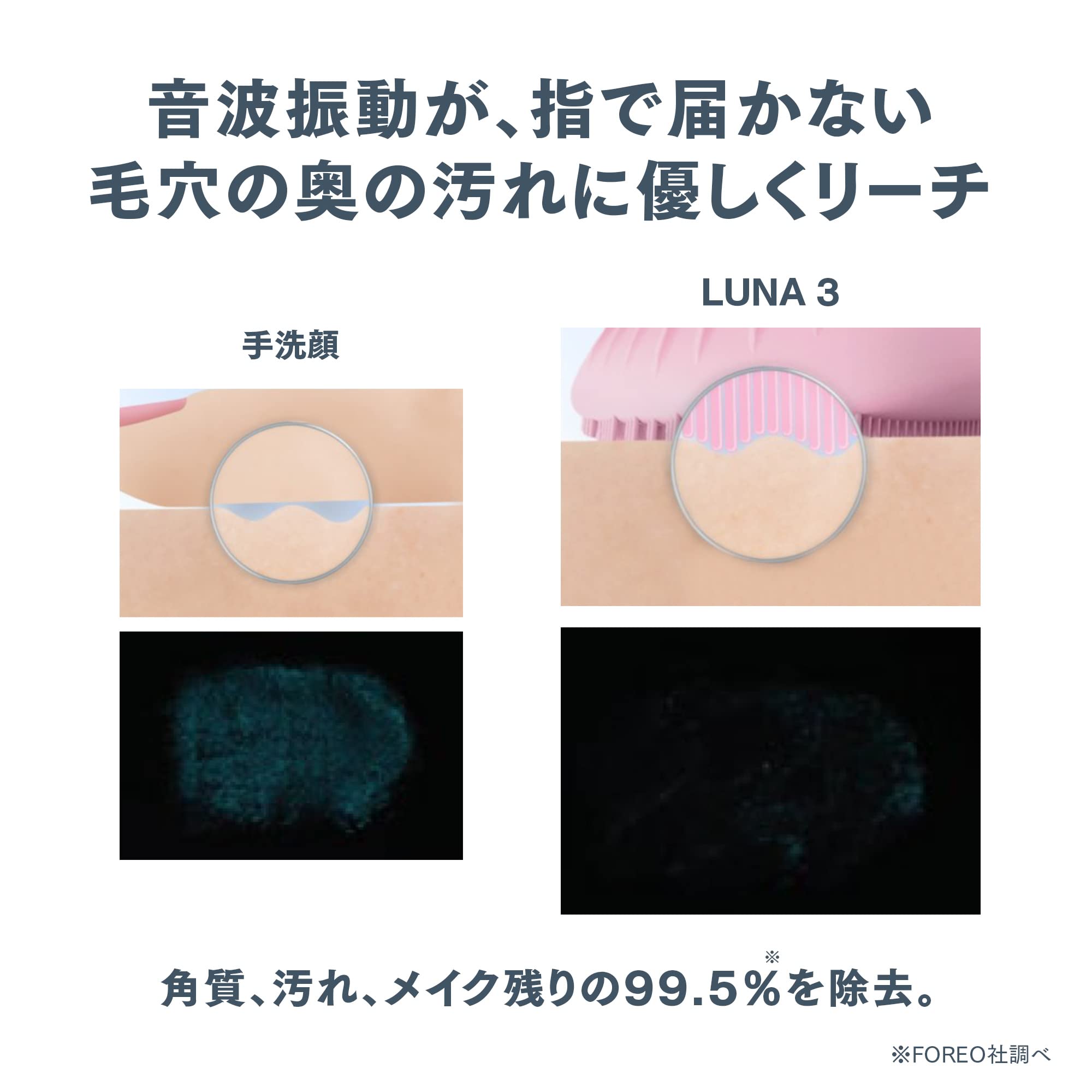 Amazon | FOREO LUNA 3ノーマルスキン パールピンク 1個 (x 1) | FOREO