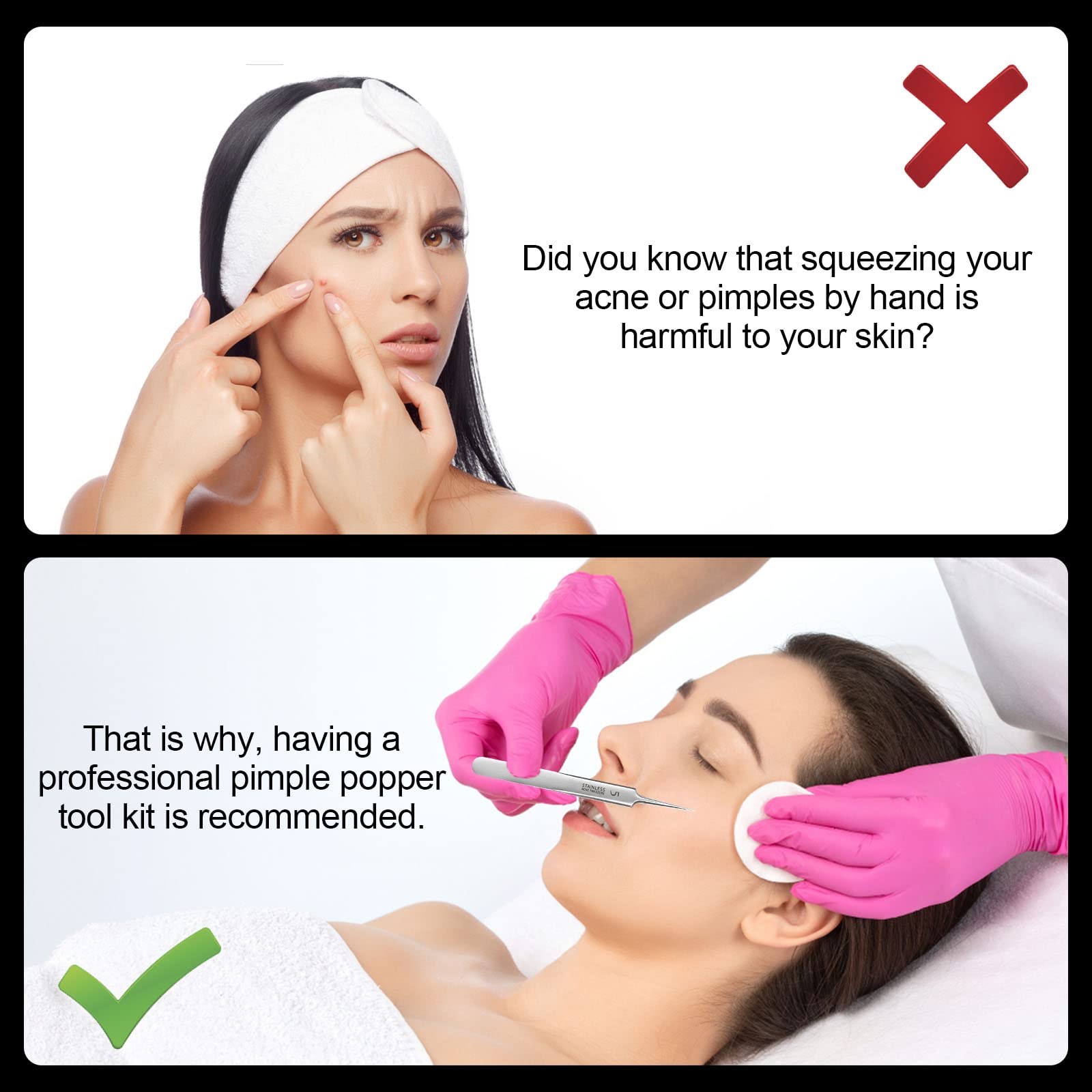 Extracteur Point Noir, Tire Comedons pour Le Visage, Brucelles, pour Points Noirs en Acier Inoxydable avec Boîte en Métal pour extracteur, boutons d'acné, taches ou retrait