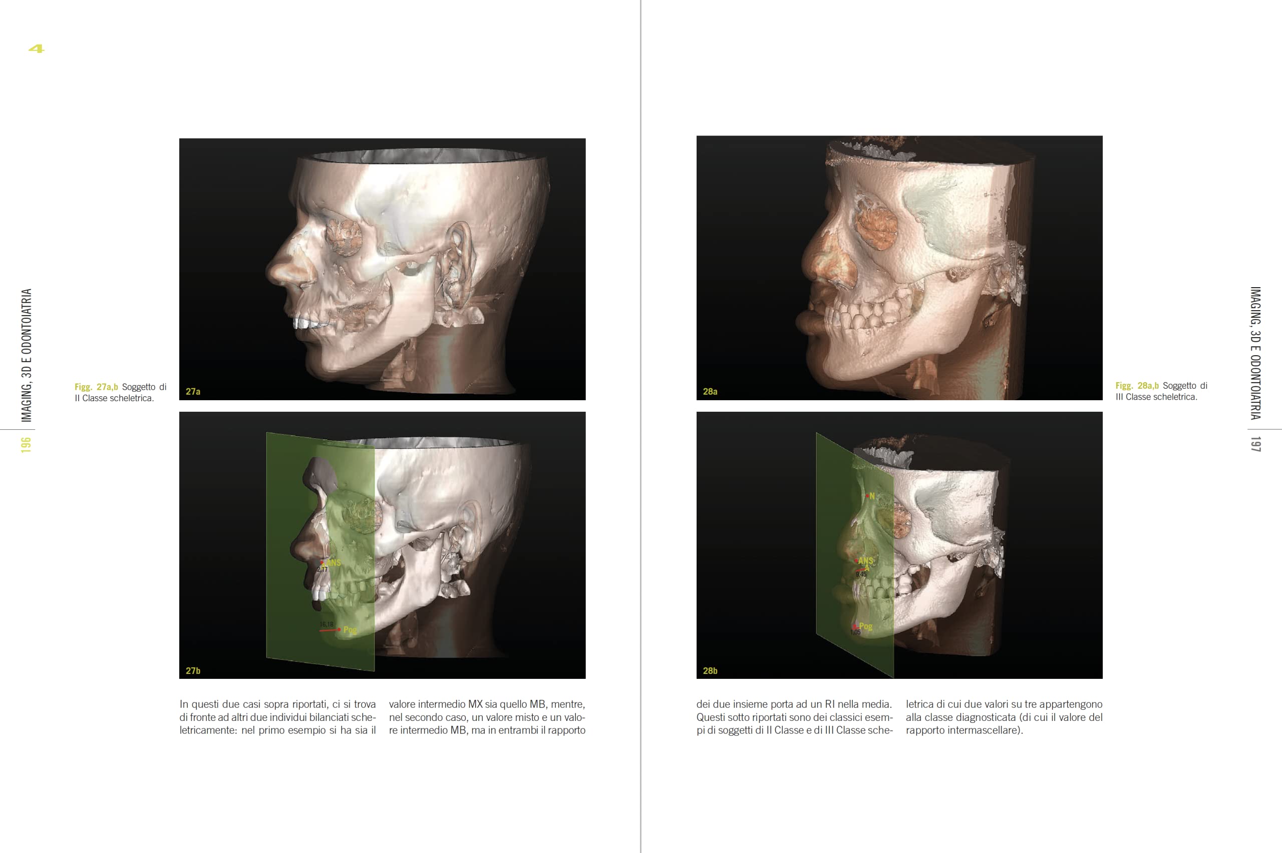 Imaging, 3D e odontoiatria. Dalla cefalometria multiplanare alla navigazione guidata in implantologia