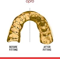 Vista 4 de OPRO Protector bucal instantáneo a medida, protector bucal para dentista, revolucionaria tecnología de ajuste para máxima comodidad, protección