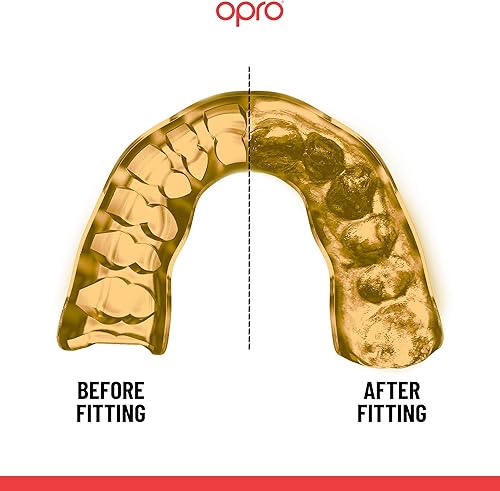 Miniatura 10 de OPRO Protector bucal deportivo instantáneo de ajuste personalizado con revolucionaria tecnología de ajuste para máxima comodidad, protección y