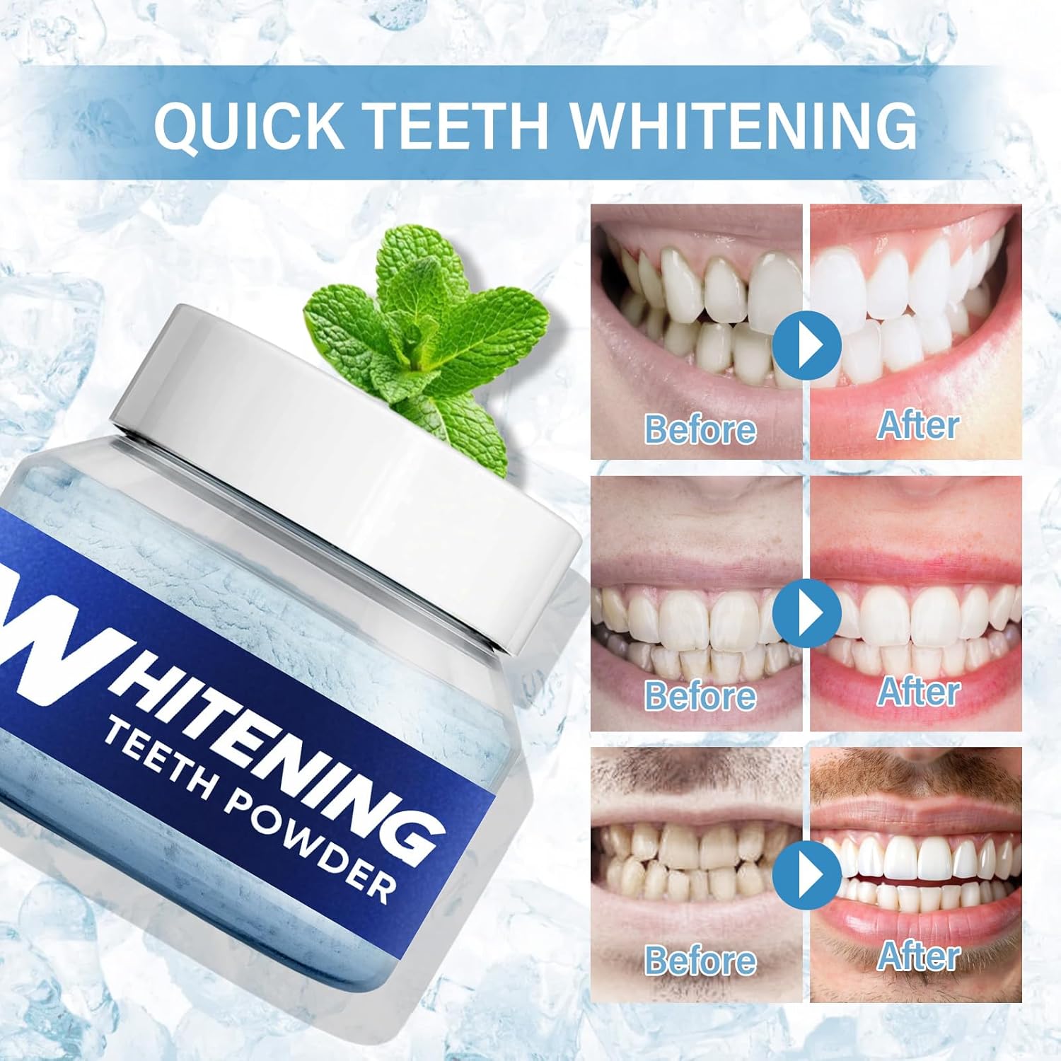 Teeth Whitening Powder, Natural Teeth Whitener, Instant Whitening and Stain Removal, No Sensitivity - Enamel-Safe for Coffee, Tea, Food, Wine, and Tobacco Stains